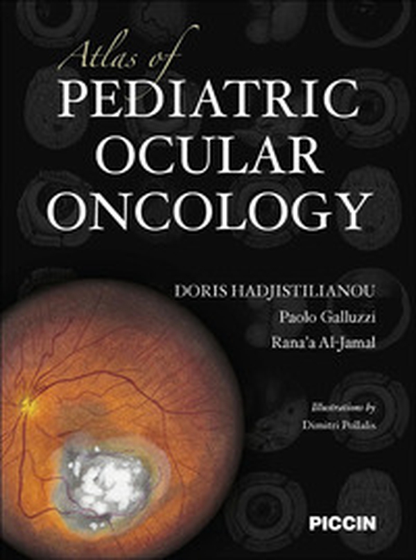 Atlas of pediatric ocular oncology - Librerie.coop