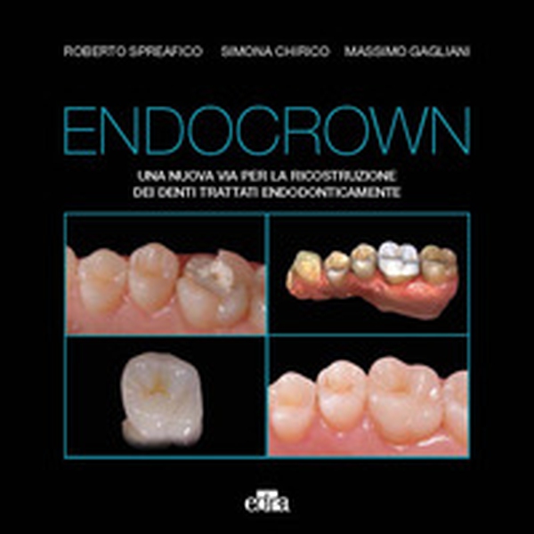 Endocrown. Una nuova via per la ricostruzione dei denti trattati endodonticamente - Librerie.coop Endocrown. Una nuova via per la ricostruzione dei denti trattati endodonticamente - Librerie.coop