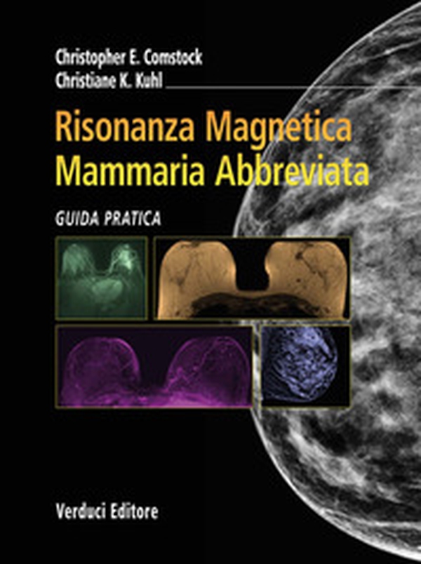 Risonanza magnetica mammaria abbreviata. Guida pratica - Librerie.coop