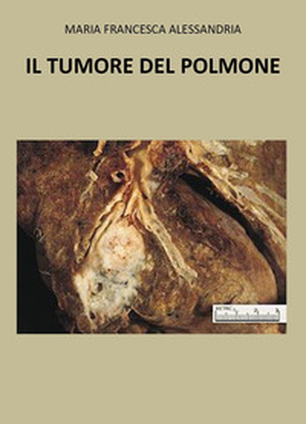 Il tumore nel polmone - Librerie.coop Il tumore nel polmone - Librerie.coop