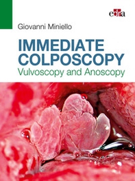 Immediate colposcopy. Vulvoscopy and anoscopy - Librerie.coop