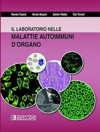 Il laboratorio nelle malattie autoimmuni d'organo - Librerie.coop Il laboratorio nelle malattie autoimmuni d'organo - Librerie.coop
