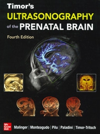 Ultrasonography of the prenatal brain - Librerie.coop
