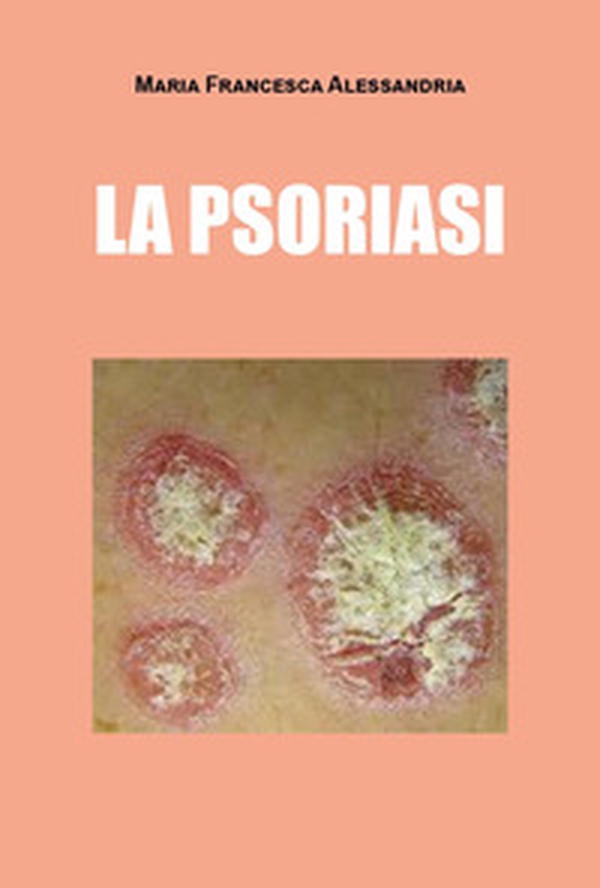 La psoriasi - Librerie.coop La psoriasi - Librerie.coop
