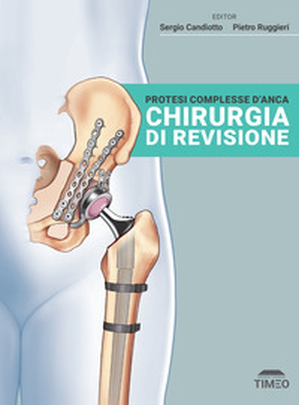 Protesi complesse d'anca. Chirurgia di revisione - Librerie.coop Protesi complesse d'anca. Chirurgia di revisione - Librerie.coop