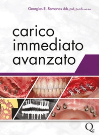 Carico immediato avanzato - Librerie.coop