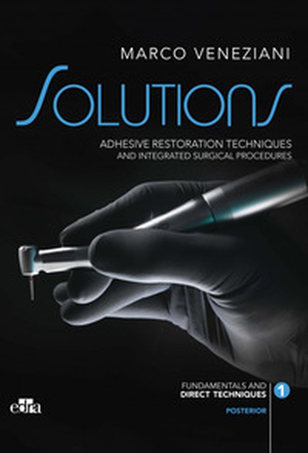 Solutions. Adhesive restoration techniques and integrated surgical procedures. Posterior - Librerie.coop Solutions. Adhesive restoration techniques and integrated surgical procedures. Posterior - Librerie.coop
