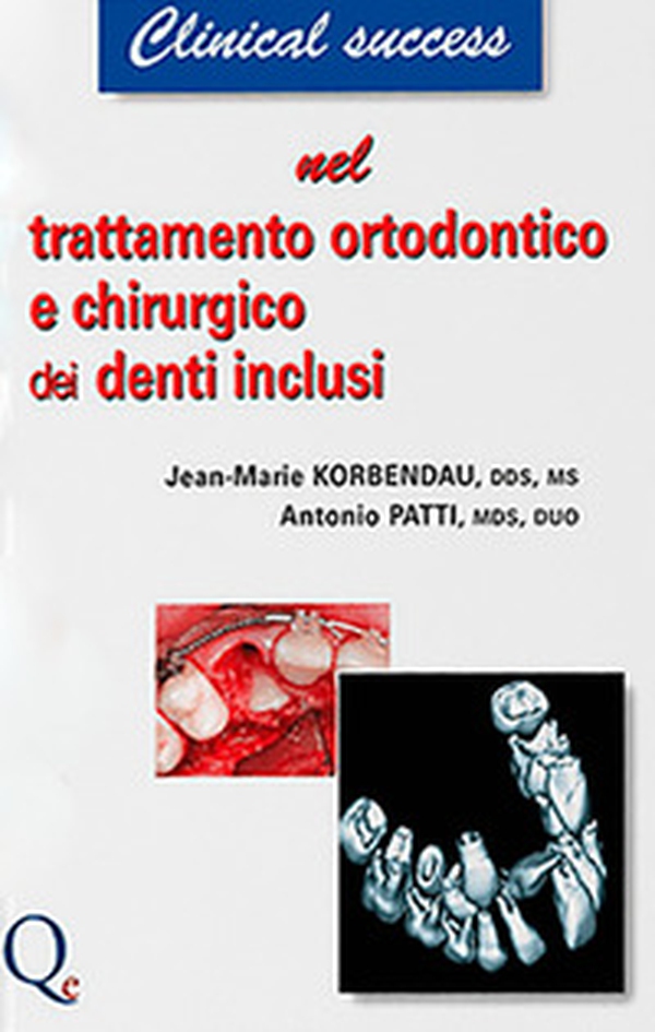Trattamento ortodontico e chirurgico dei denti inclusi - Librerie.coop Trattamento ortodontico e chirurgico dei denti inclusi - Librerie.coop