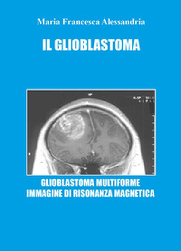 Il glioblastoma - Librerie.coop Il glioblastoma - Librerie.coop