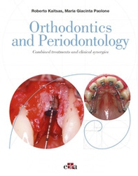 Orthodontics and Periodontology. Combined treatments and clinical synergies - Librerie.coop Orthodontics and Periodontology. Combined treatments and clinical synergies - Librerie.coop