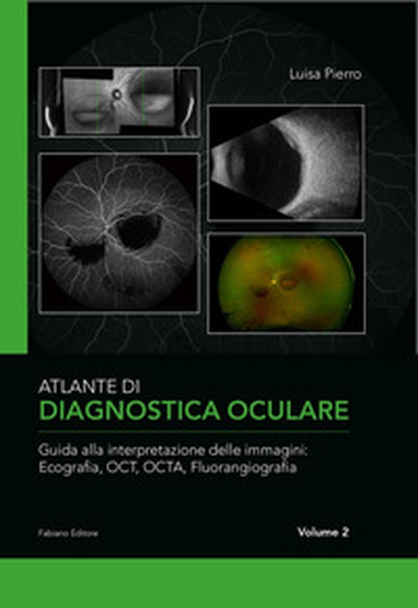 Atlante di diagnostica oculare - Librerie.coop
