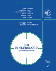 RM in neurologia (tumori cerebrali) - Librerie.coop