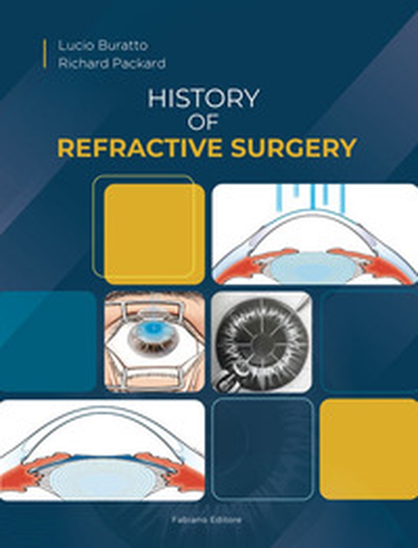 History of refractive surgery - Librerie.coop
