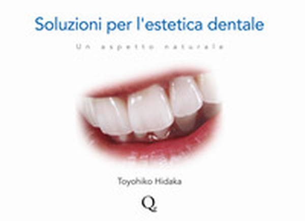 Soluzioni per l'estetica dentale. Un aspetto naturale - Librerie.coop Soluzioni per l'estetica dentale. Un aspetto naturale - Librerie.coop