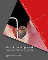 Malattie peri-implantari. Trattamenti chirurgici - Librerie.coop Malattie peri-implantari. Trattamenti chirurgici - Librerie.coop