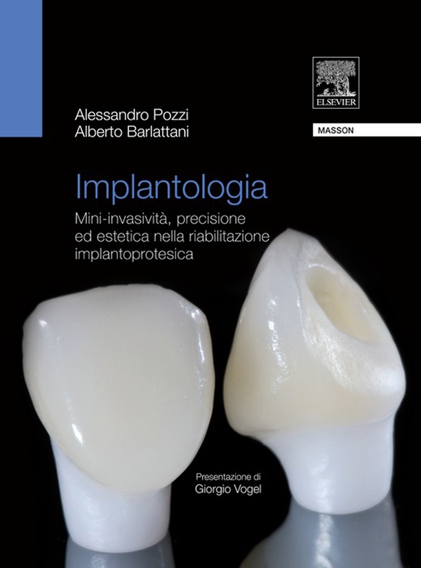 Implantologia - Librerie.coop Implantologia - Librerie.coop