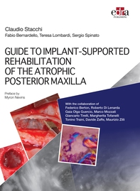 GUIDE TO IMPLANT-SUPPORTED REHABILITATION OF THE ATROPHIC POSTERIOR MAXILLA - Librerie.coop GUIDE TO IMPLANT-SUPPORTED REHABILITATION OF THE ATROPHIC POSTERIOR MAXILLA - Librerie.coop