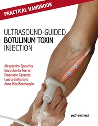 Practical handbook for ultrasound-guided botulinum toxin injection - Librerie.coop