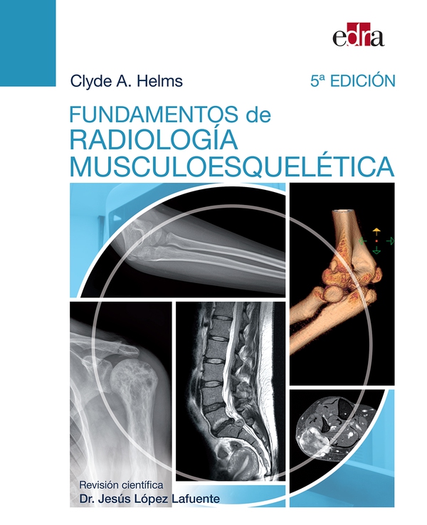 Fundamentos de radiología musculoesquelética - Librerie.coop Fundamentos de radiología musculoesquelética - Librerie.coop