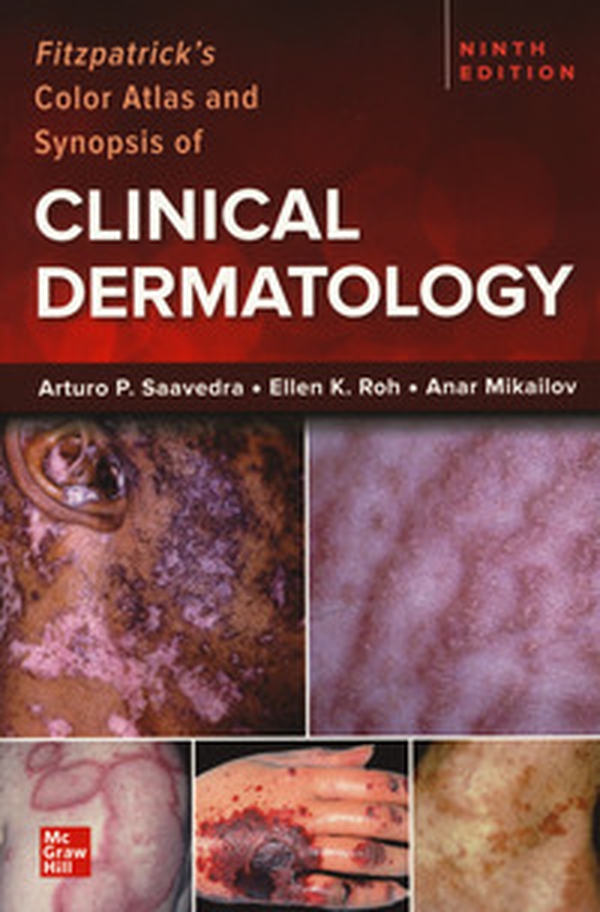 Fitzpatrick's color atlas and synopsis of clinical dermatology - Librerie.coop Fitzpatrick's color atlas and synopsis of clinical dermatology - Librerie.coop