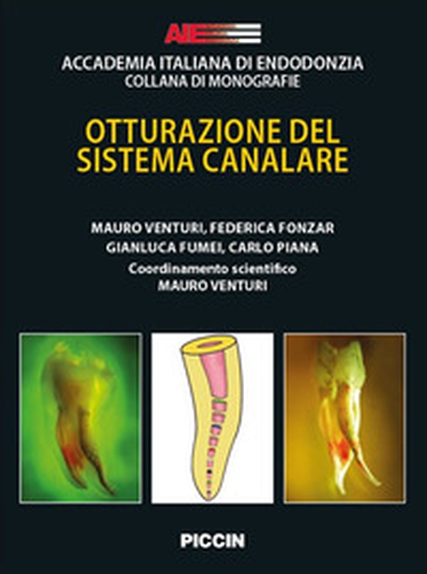 Otturazione del sistema canalare - Librerie.coop Otturazione del sistema canalare - Librerie.coop