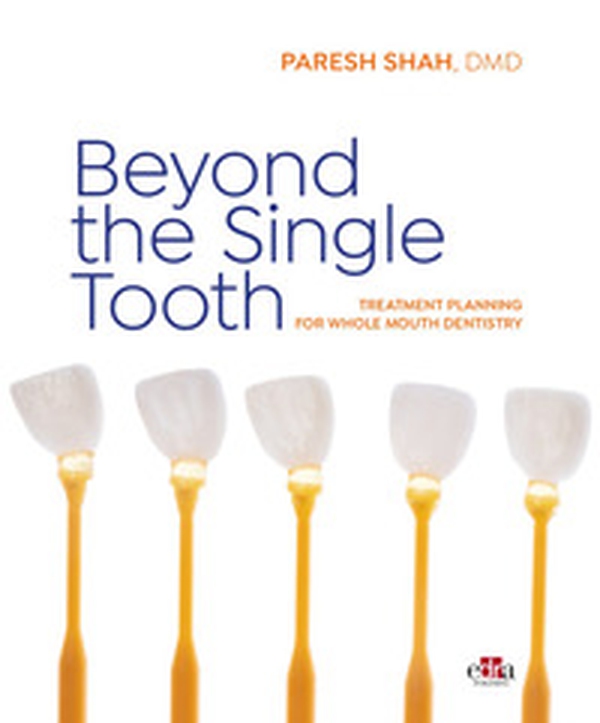 Beyond the Single Tooth. Treatment planning for whole mouth dentistry - Librerie.coop Beyond the Single Tooth. Treatment planning for whole mouth dentistry - Librerie.coop