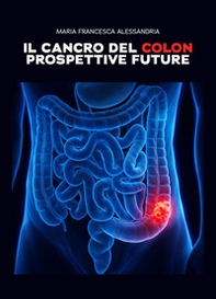 Il cancro del colon. Prospettive future - Librerie.coop