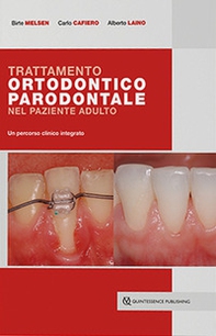 Trattamento ortodontico parodontale nel paziente adulto. Un percorso clinico integrato - Librerie.coop