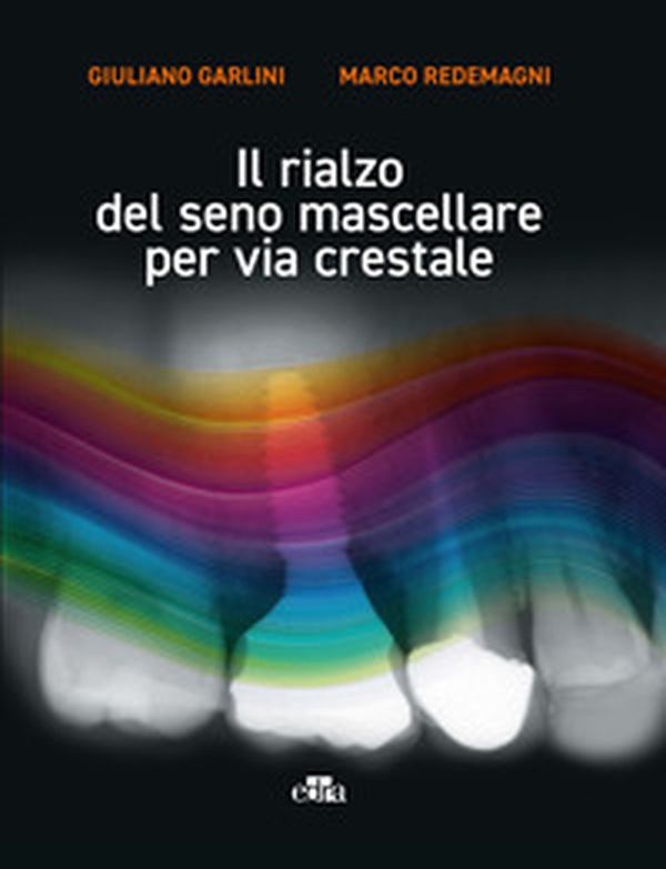 Il rialzo del seno mascellare per via crestale - Librerie.coop Il rialzo del seno mascellare per via crestale - Librerie.coop