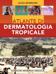 Atlante di dermatologia tropicale - Librerie.coop
