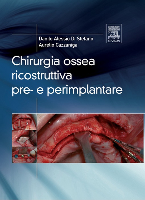 Chirurgia ossea ricostruttiva pre- e perimplantare - Librerie.coop Chirurgia ossea ricostruttiva pre- e perimplantare - Librerie.coop