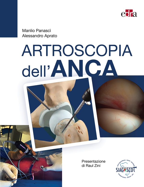 Artroscopia dell'anca - Librerie.coop Artroscopia dell'anca - Librerie.coop