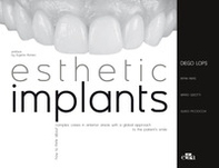 Esthetic implants. How to think about complex cases in anterior areas with a global approach to the patient' s smile - Librerie.coop