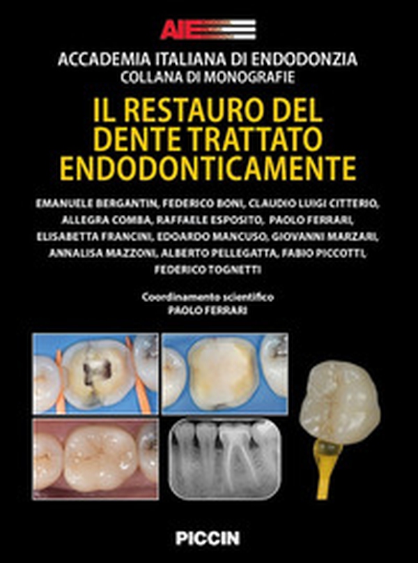 Il restauro del dente trattato endodonticamente - Librerie.coop Il restauro del dente trattato endodonticamente - Librerie.coop