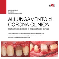 Allungamento di corona clinica. Razionale biologico e applicazione clinica - Librerie.coop