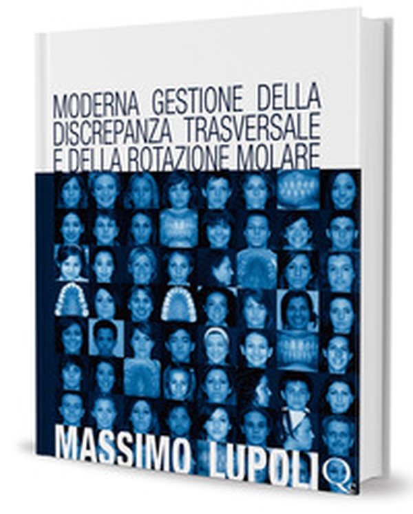 Moderna gestione della discrepanza trasversale e della rotazione molare. Il palatal expander - Librerie.coop Moderna gestione della discrepanza trasversale e della rotazione molare. Il palatal expander - Librerie.coop