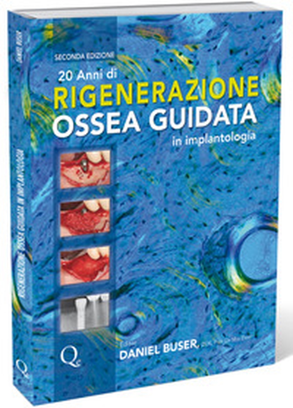 20 anni di rigenerazione ossea guidata in implantologia - Librerie.coop 20 anni di rigenerazione ossea guidata in implantologia - Librerie.coop