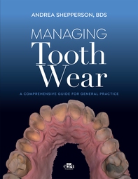 Managing Tooth Wear - Librerie.coop