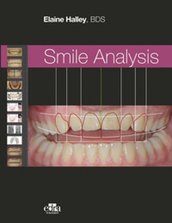 Smile analysis. Ediz. italiana - Librerie.coop Smile analysis. Ediz. italiana - Librerie.coop