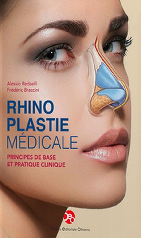 Rhinoplastie médicale. Principes de base et pratique clinique - Librerie.coop