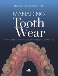 Managing tooth Wear. A comprehensive guide for general practice - Librerie.coop