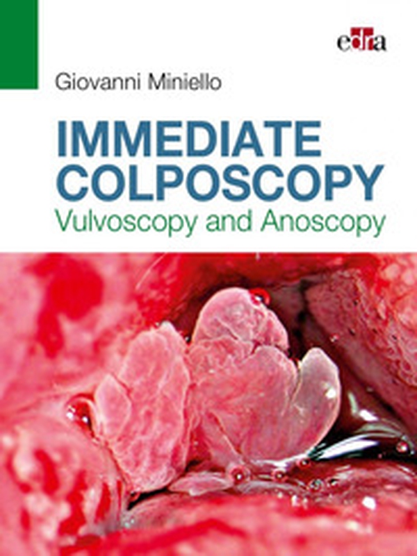 Immediate colposcopy. Vulvoscopy and anoscopy - Librerie.coop Immediate colposcopy. Vulvoscopy and anoscopy - Librerie.coop
