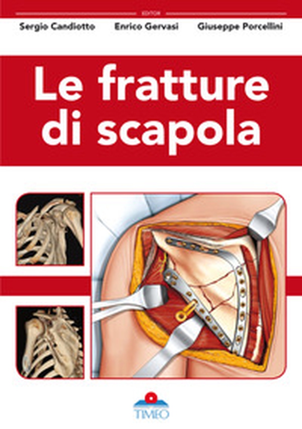 Le fratture di scapola - Librerie.coop