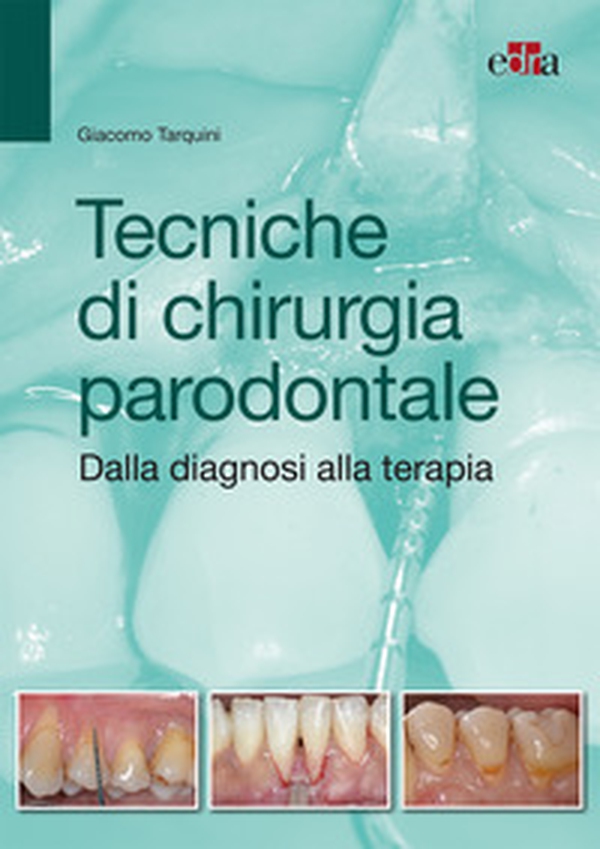 Tecniche di chirurgia parodontale. Dalla diagnosi alla terapia - Librerie.coop Tecniche di chirurgia parodontale. Dalla diagnosi alla terapia - Librerie.coop