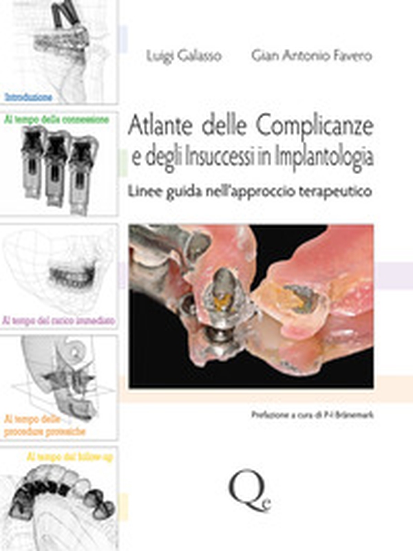 Atlante delle complicanze e degli insuccessi in implantologia. Linee guida nell'approccio terapeutico - Librerie.coop Atlante delle complicanze e degli insuccessi in implantologia. Linee guida nell'approccio terapeutico - Librerie.coop
