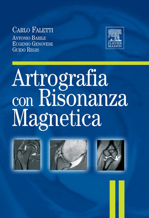 Artrografia con risonanza magnetica - Librerie.coop Artrografia con risonanza magnetica - Librerie.coop