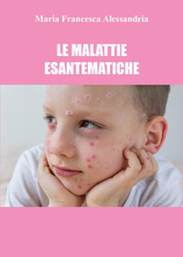 Le malattie esantematiche - Librerie.coop Le malattie esantematiche - Librerie.coop