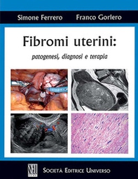 Fibromi uterini: patogenesi, diagnosi e terapia - Librerie.coop
