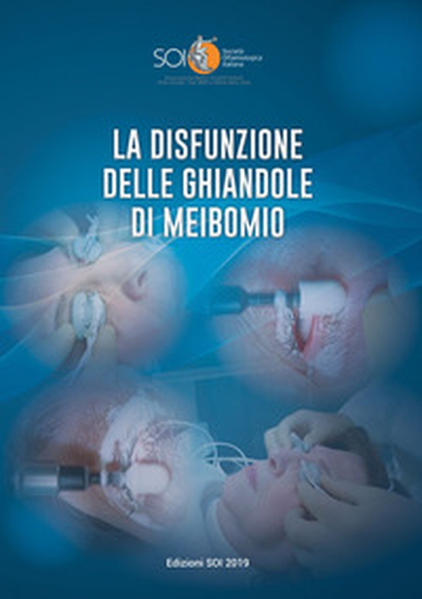 La disfunzione delle ghiandole di Meibomio. Relazione Ufficiale SOI 2019 - Librerie.coop