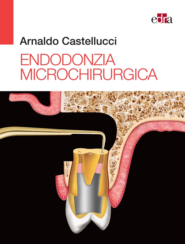 Endodonzia Microchirurgica - Librerie.coop Endodonzia Microchirurgica - Librerie.coop